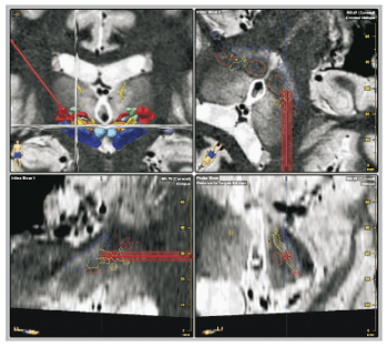 Imagerie preop